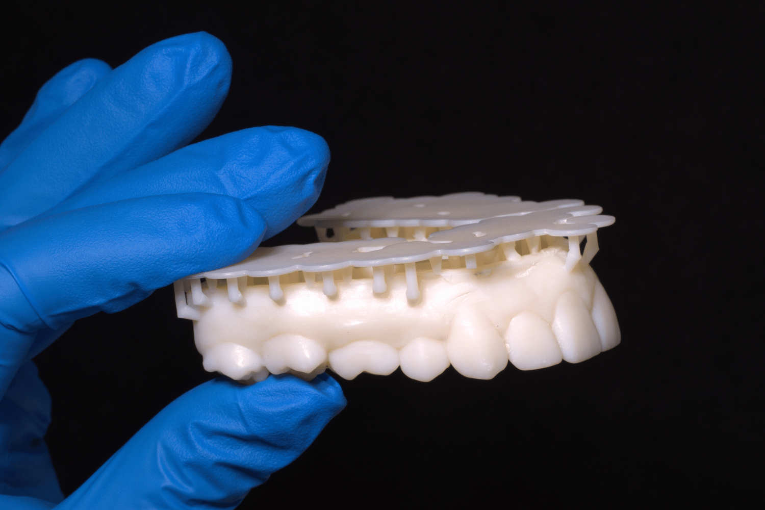 impresion-3d-dental-modelo-con-soportes-en-proceso